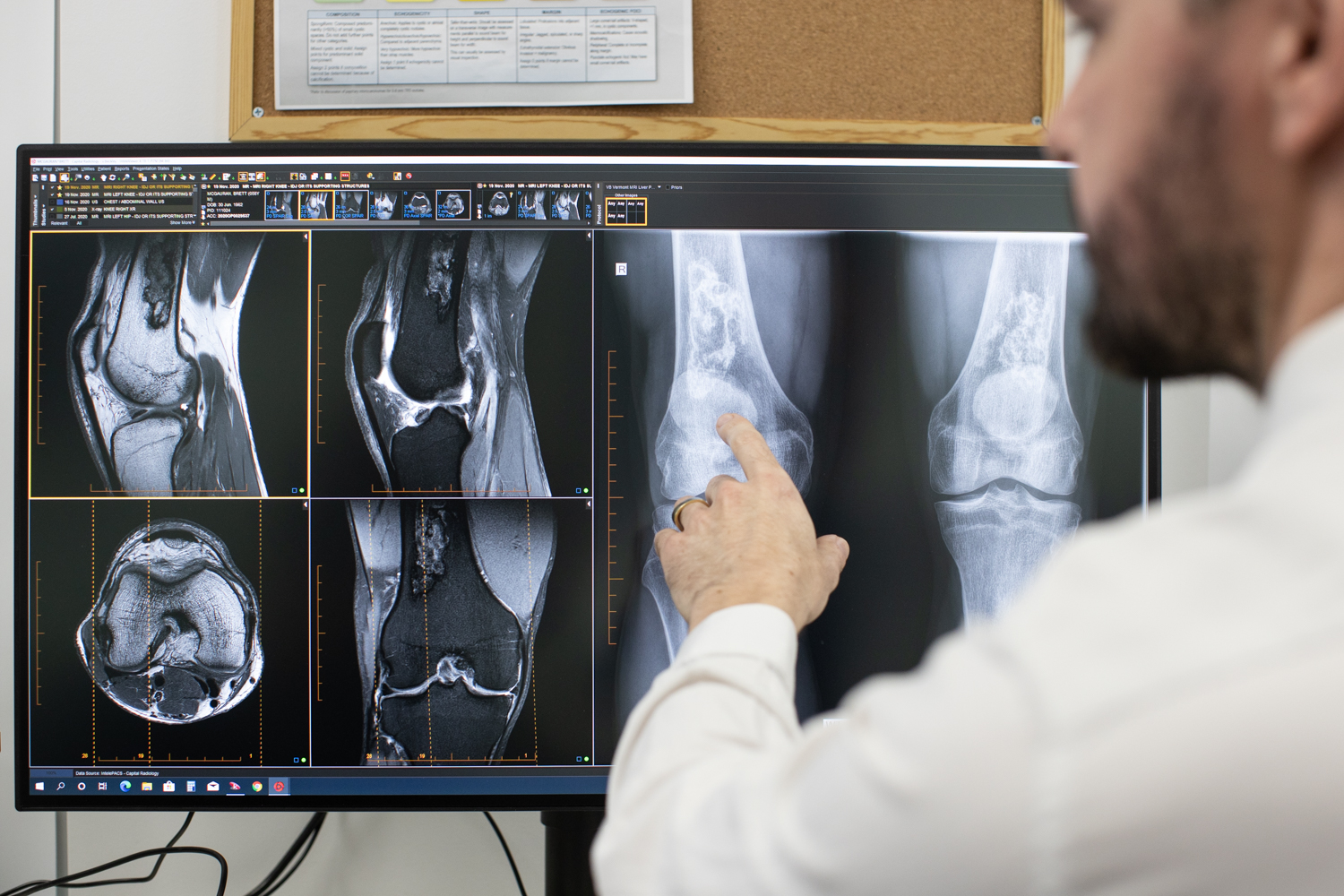 Doctors Explaining Medical X ray Result to Male Patient | MRI Diagnostic Centre | Capital Radiology