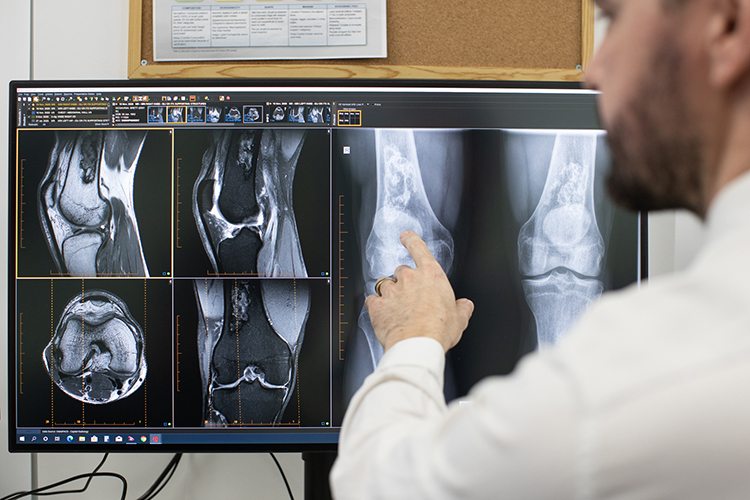 A radiologist reviews musculoskeletal imaging on a large monitor, pointing to findings on knee scans.
